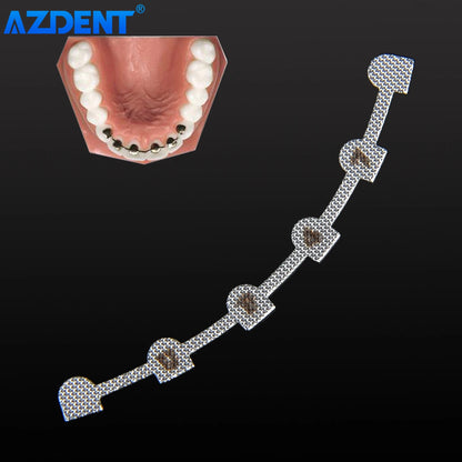 Contention palatine ou linguale orthodontique 10 Pcs/sachet