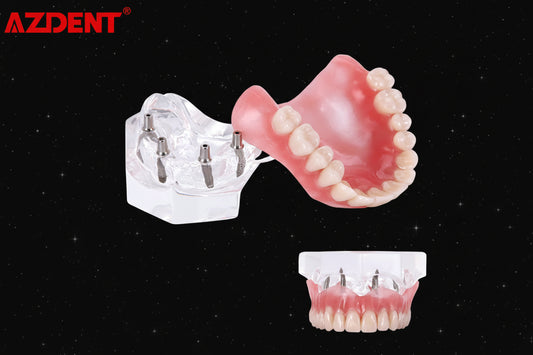 AZDENT modèle de prothèse amovible sur attachement implantaire